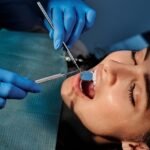 Composite Fillings